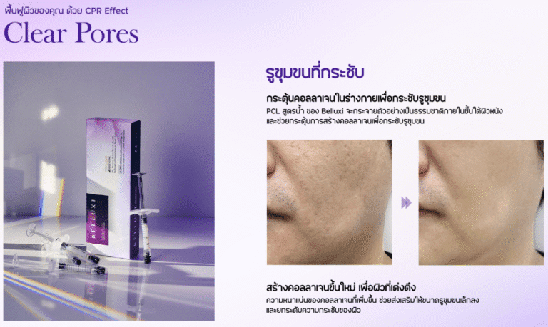 ผลลัพธ์รูขุมขนกระชับจาก Belluxi