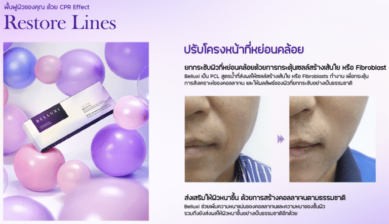 ผลลัพธ์การฟื้นฟูโครงหน้าจาก Belluxi