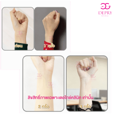 Neowhite dePryClinic พิษณุโลก ฉีดผิวพิษณุโลก